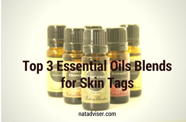 Best Essential Oils for Skin Tags Removal + 3 Top Recipes