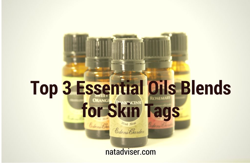 Best Essential Oils for Skin Tags Removal + 3 Top Recipes