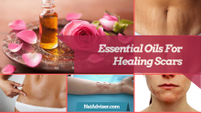 9 Best Essential Oils For Healing Scars And Methods To Treat Scars With Essential Oils